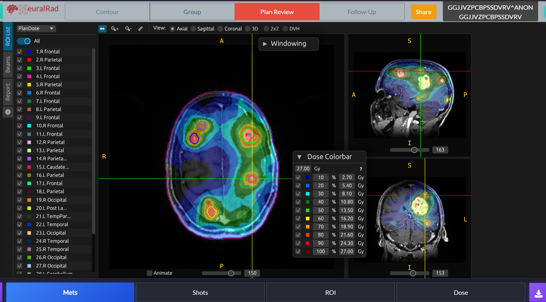 Dose Map Visualization
