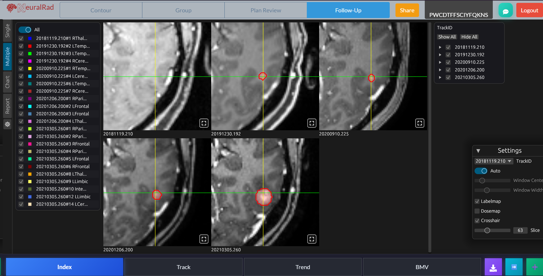 Longitudinal Lesion Tracking