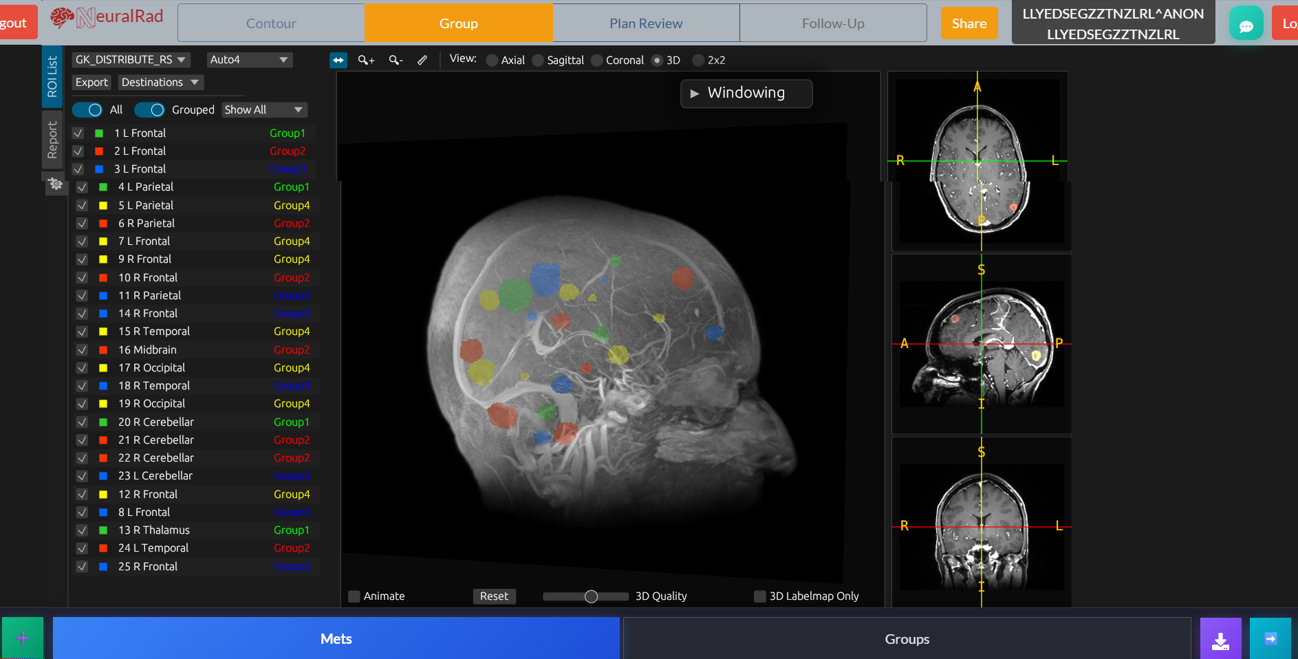 Treatment Session Grouping