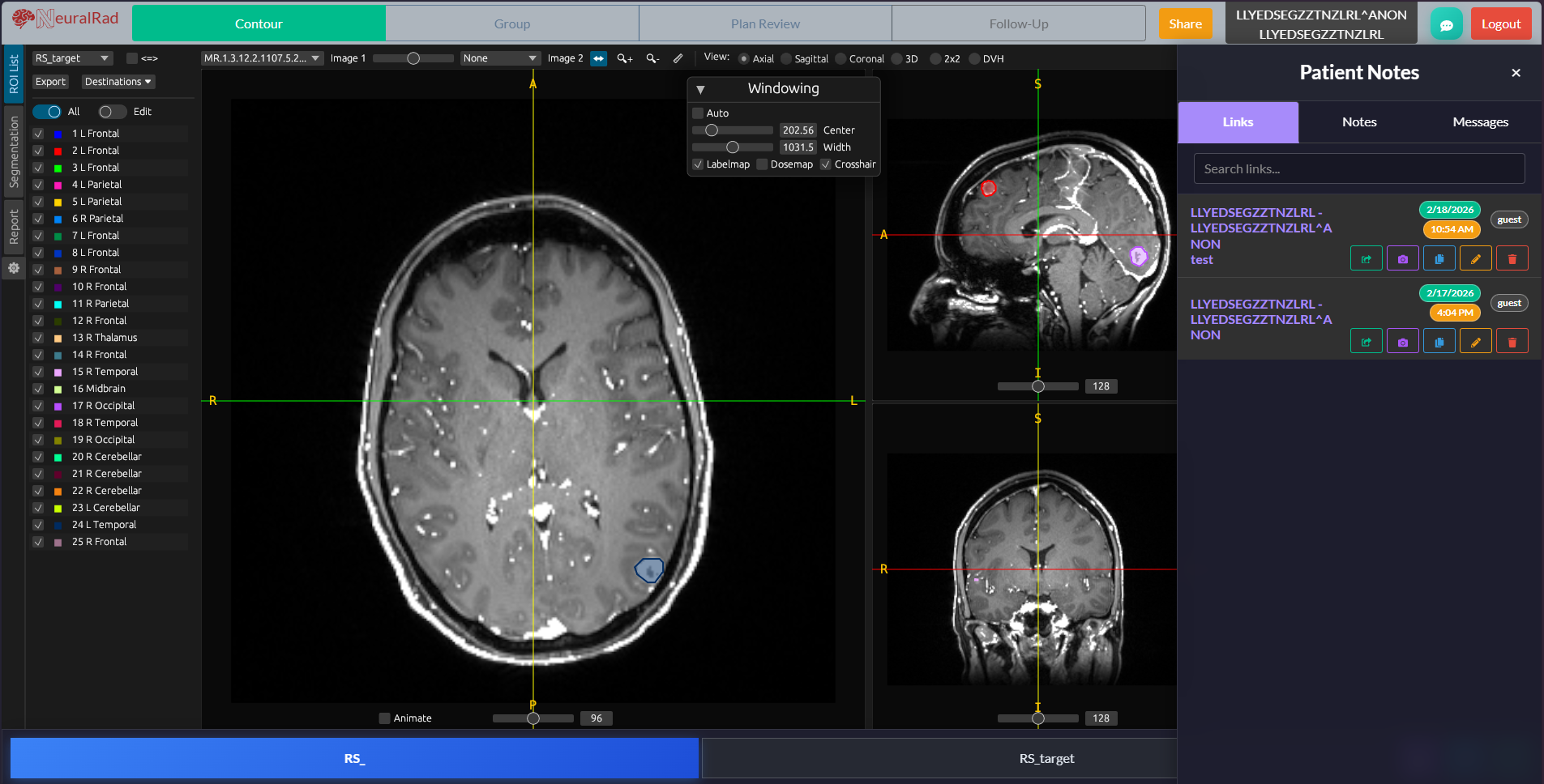 Patient Notes & Collaboration